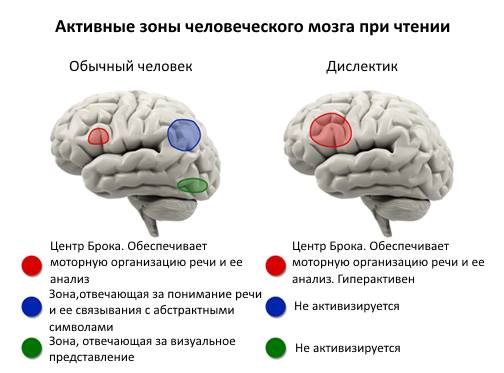 Детская Дислексия: Определение, Характеристики, Типы, Симптомы, Упражнения и Лечение